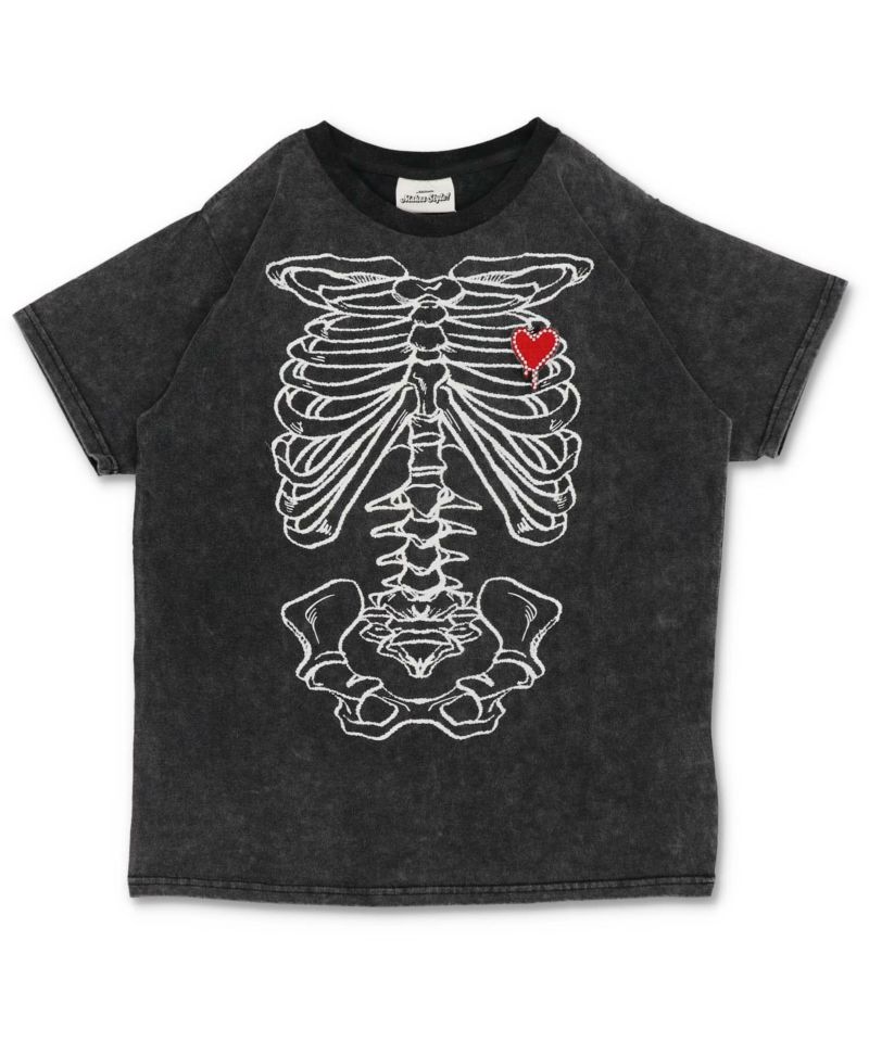 ブラックケミカル